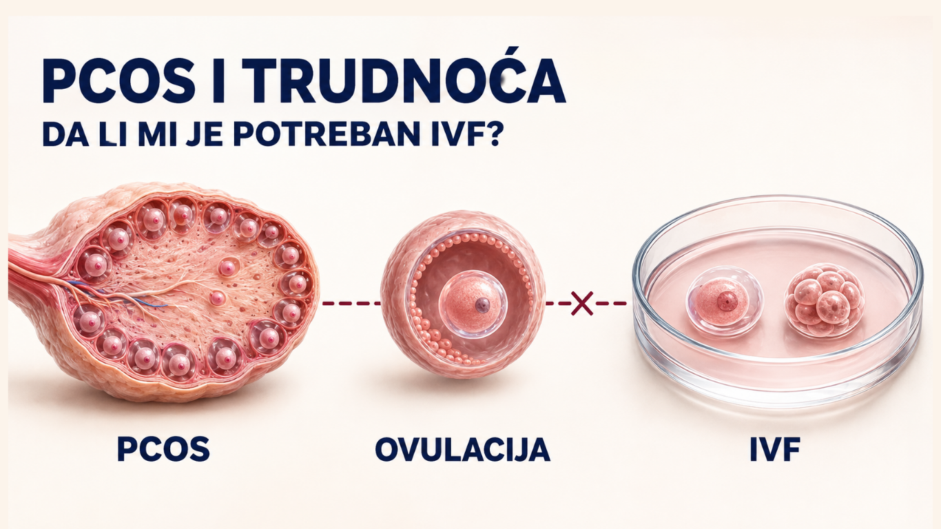 PCOS i trudnoća: mogu li zatrudnjeti i da li mi je potreban IVF?