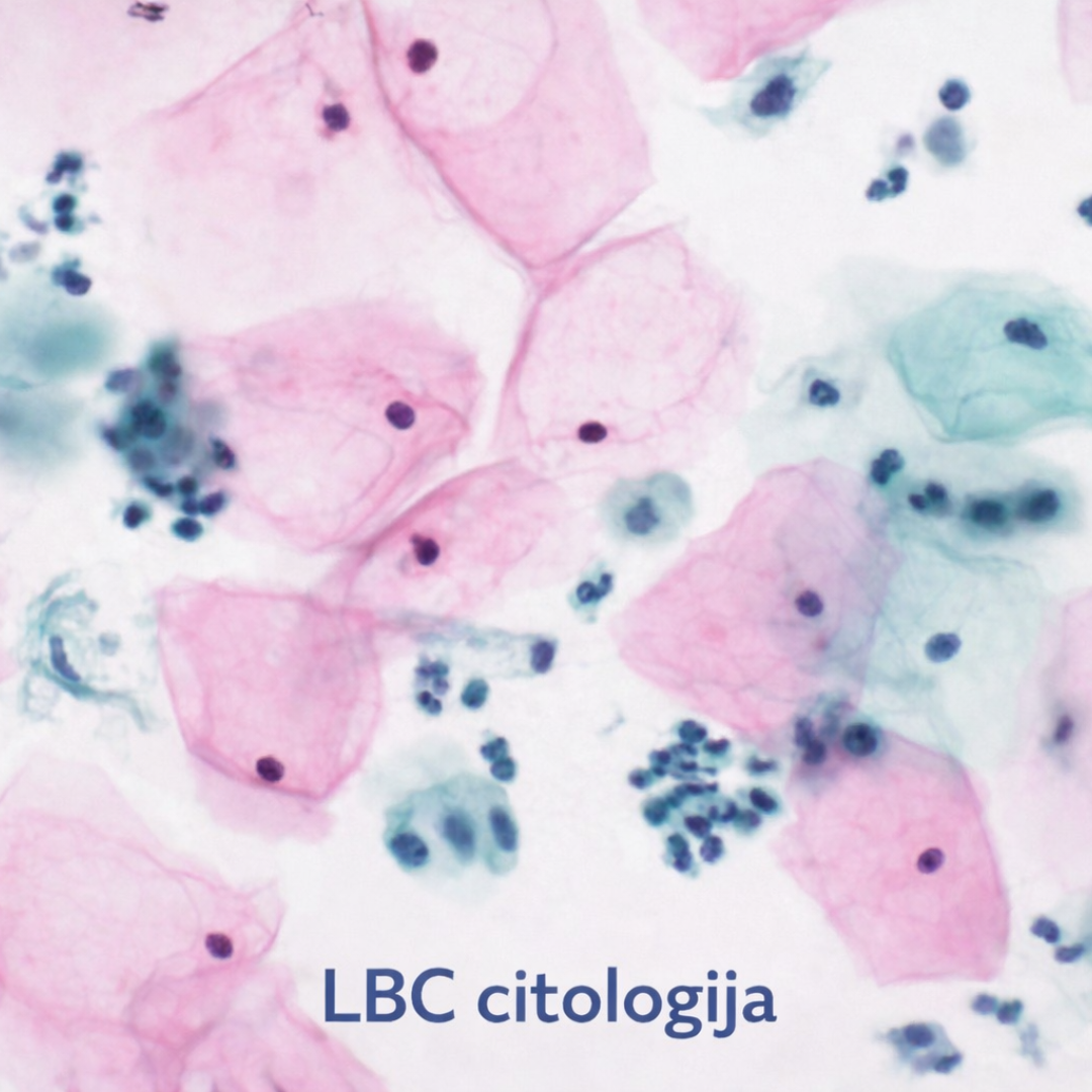 Prevencija raka grlića materice i otkrivanje bolesti u ranoj fazi